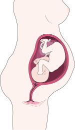 Grafische illustratie van een zwangerschap