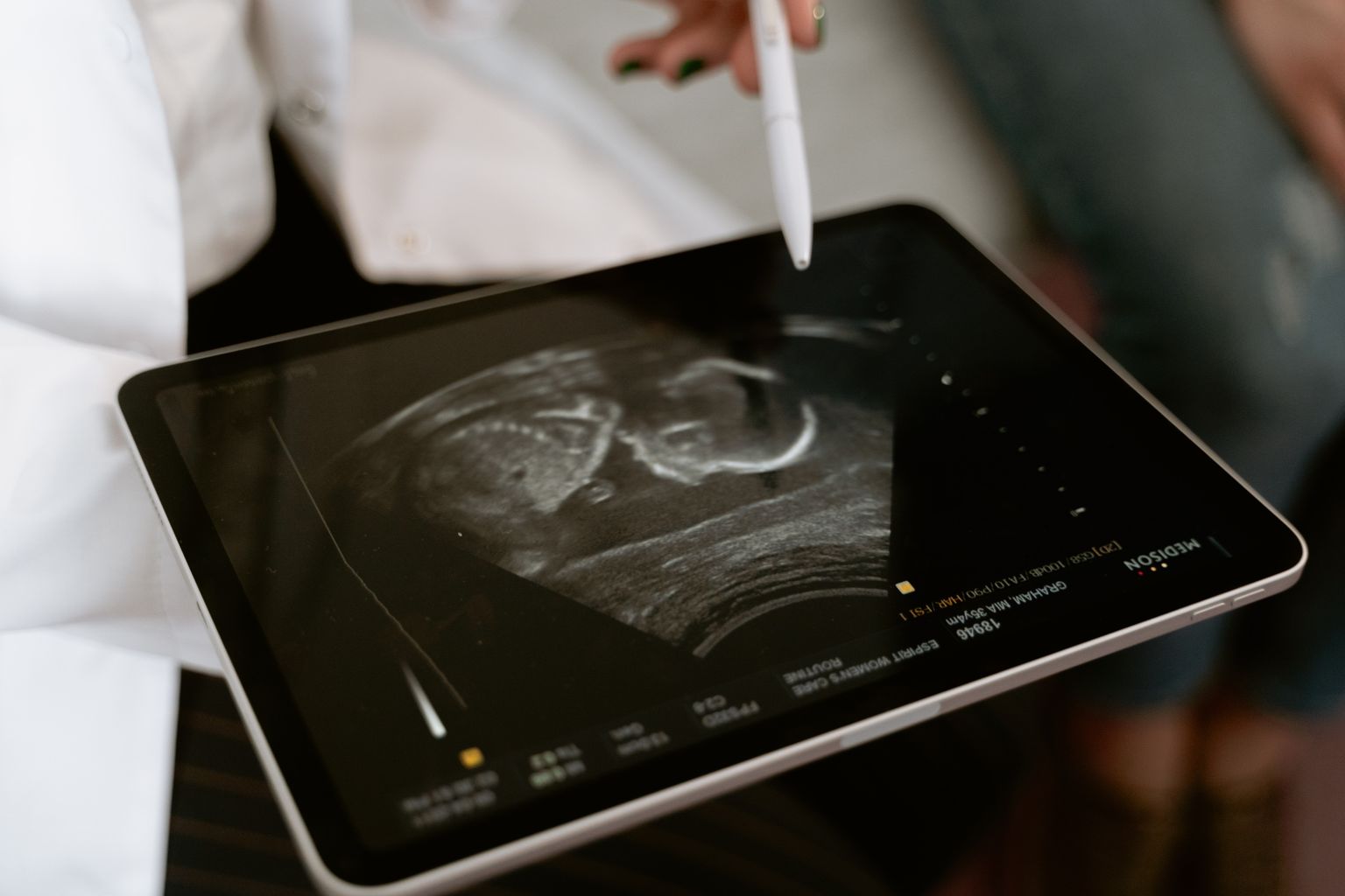 Imagem de ultrassom num tablet