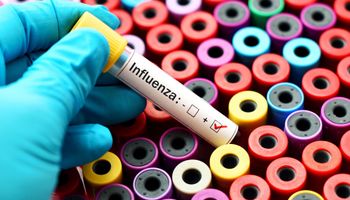 Positive blood sample with influenza virus