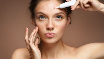Teen girl with problem free skin applying treatment cream on beige background. Skin care concept