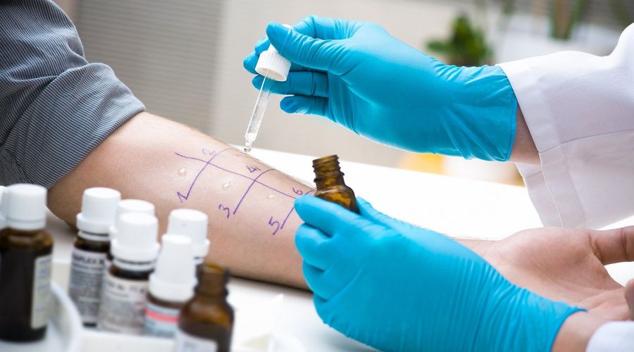 Allergy test is performed by a specialist.