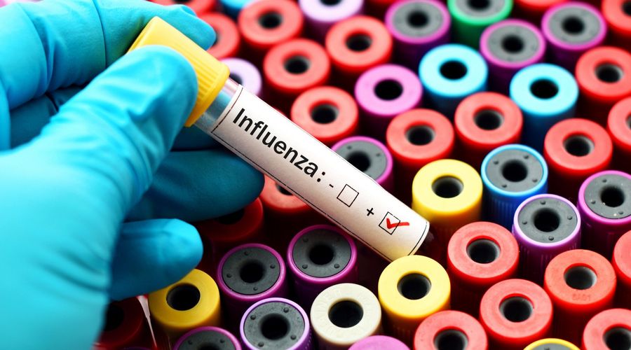 Positive Blutprobe mit Influenzavirus
