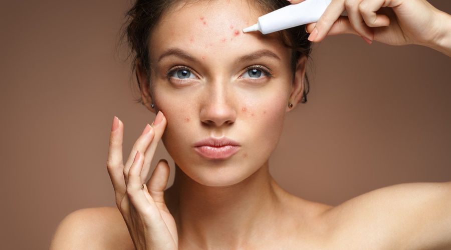 Teenmädchen mit problemloser Haut, die auf beigem Hintergrund eine Behandlungscreme aufträgt. Hautpflegekonzept