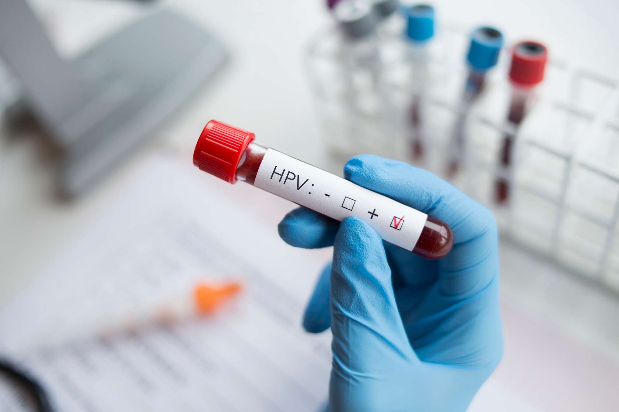 Prueba del VPH positiva