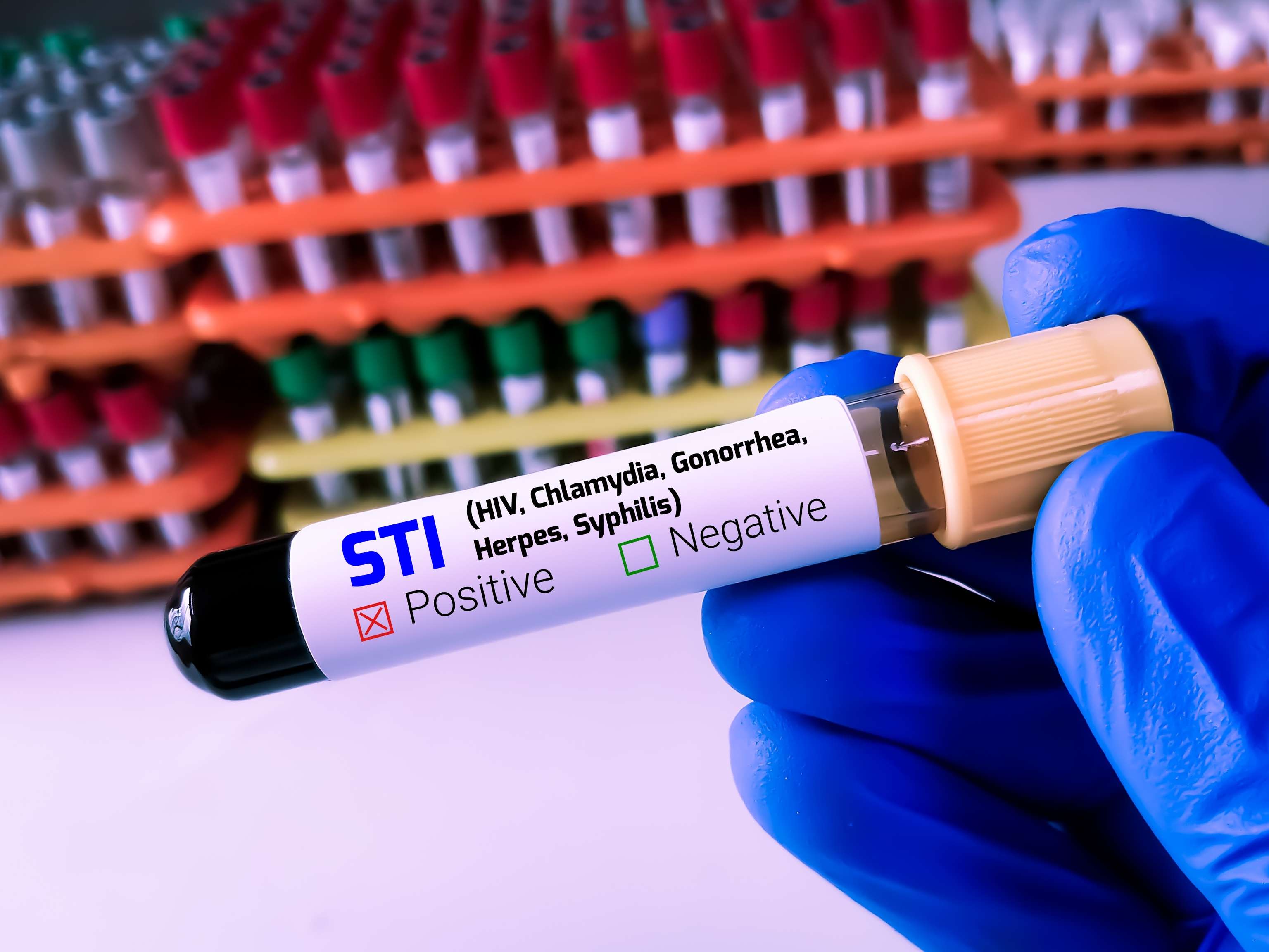 Aumento del número de análisis de sangre positivos
