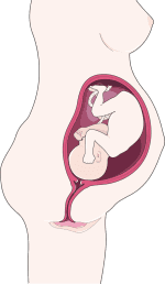 Ilustração gráfica de uma gravidez
