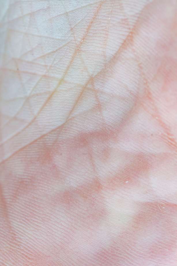 Warum empfehlen Dermatologen Retinol? Erfahren Sie mehr über seine Vorteile