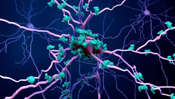 Tod Neuronen Gehirn