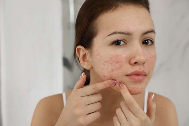 Menina adolescente com problemas de acne a espremer borbulha dentro de casa