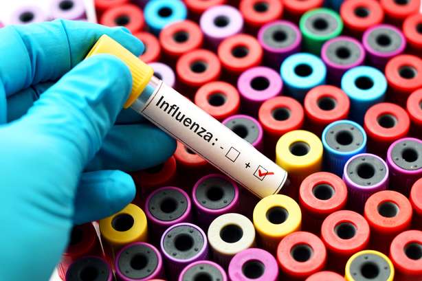 Eine positive Blutprobe mit dem Influenzavirus. Positive Blutprobe mit Influenzavirus