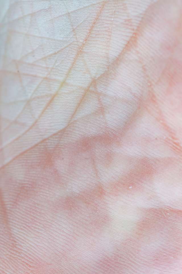 Warum empfehlen Dermatologen Retinol? Erfahren Sie mehr über seine Vorteile