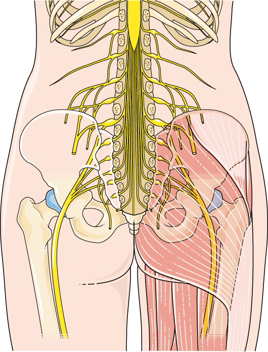 Grafische Darstellung des Ischiasplexus