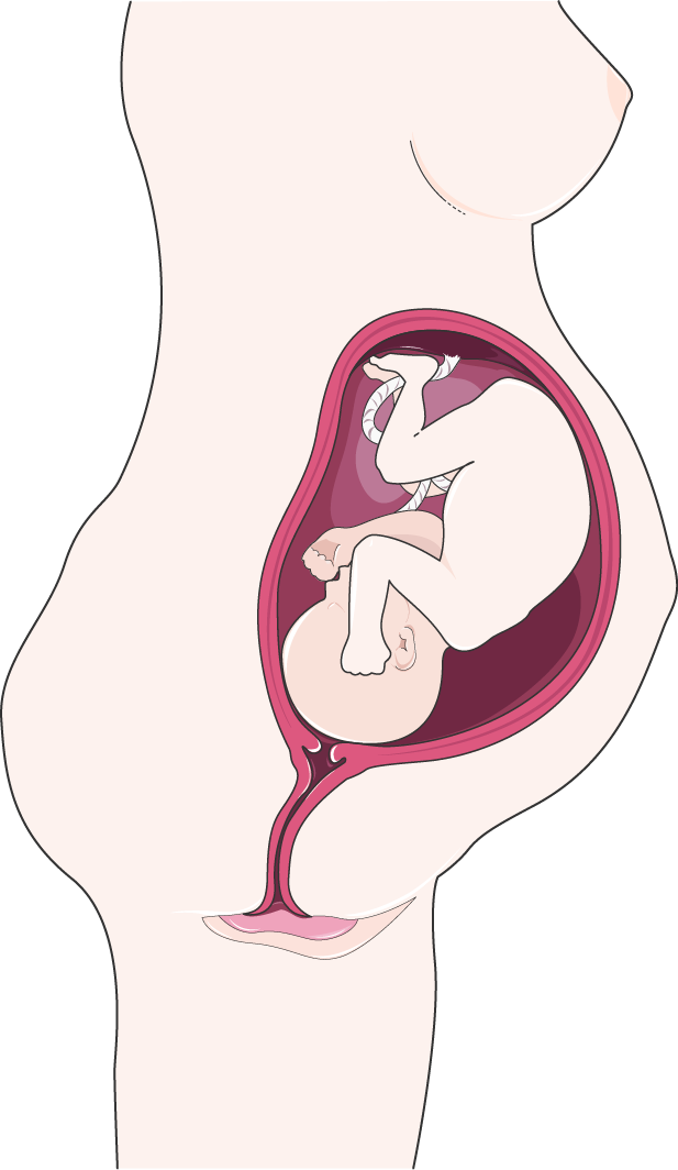 Illustrazione della gravidanza