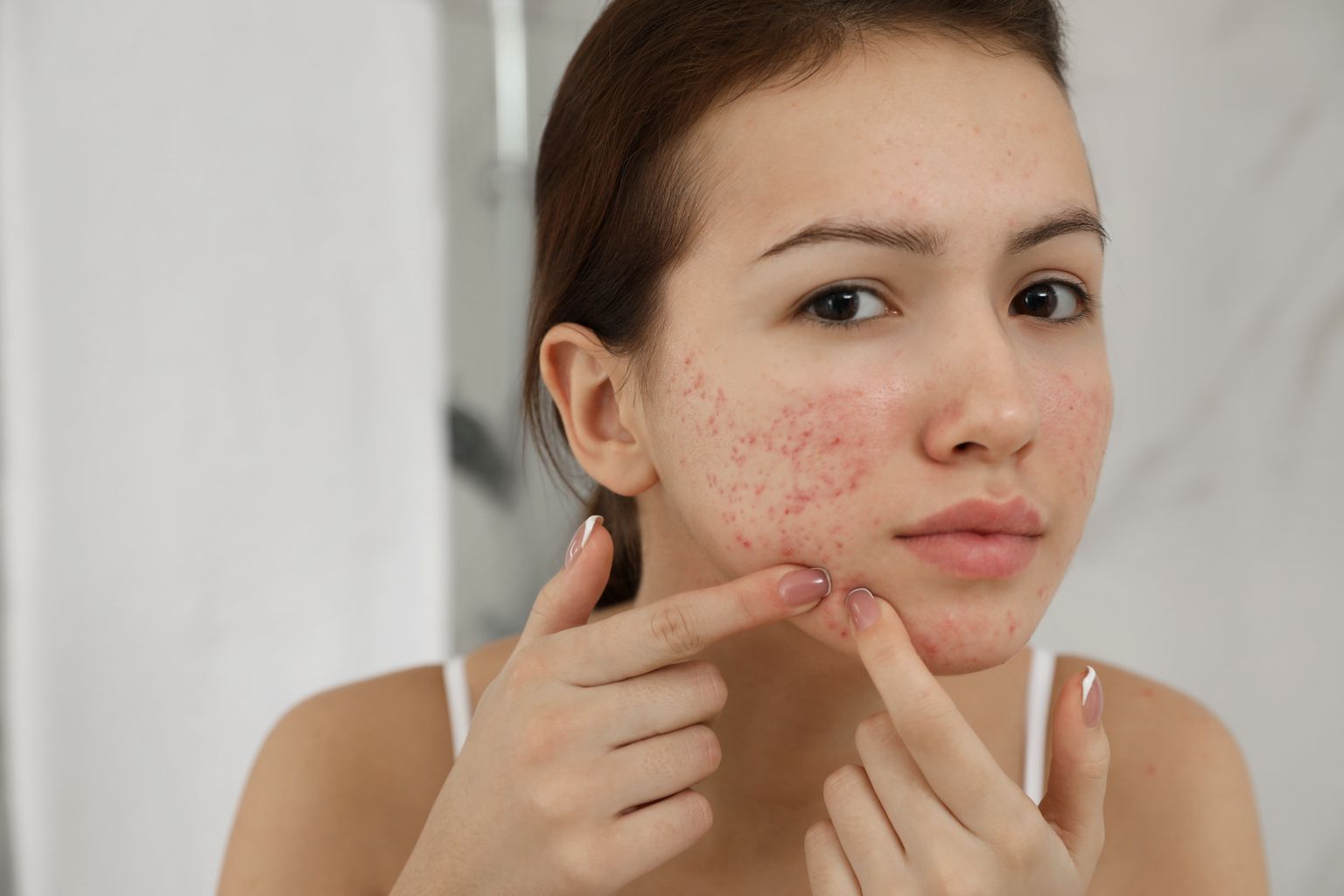 Menina adolescente com problemas de acne a espremer borbulha dentro de casa 