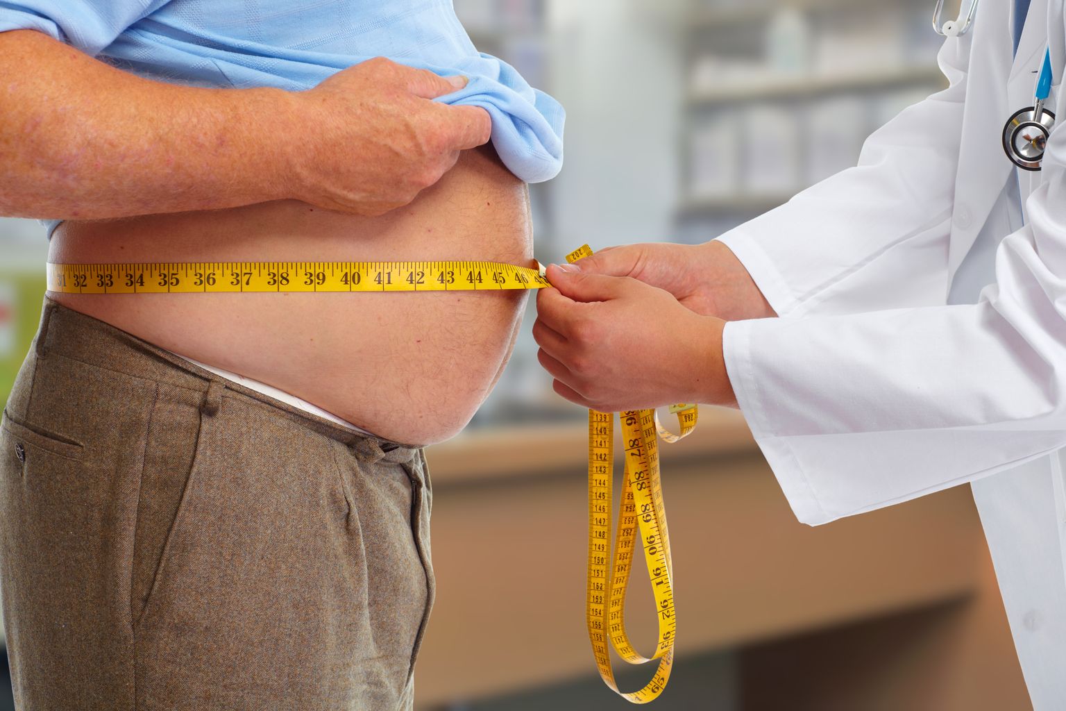 Arzt, der fettleibiges menschliches Körperfett misst. Fettleibigkeit und Gewichtsverlust.