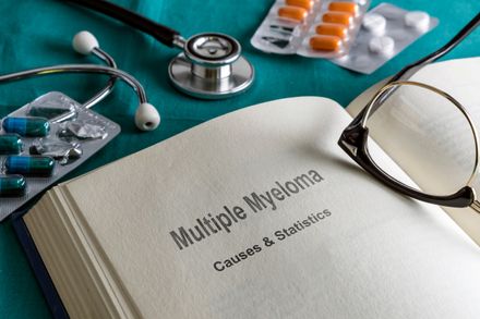 Open Book Of prostate multiple myeloma, Conceptual Image
