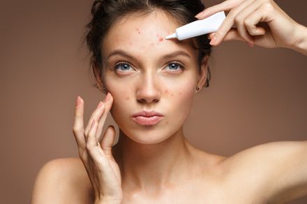 Teenmädchen mit problemloser Haut, die auf beigem Hintergrund eine Behandlungscreme aufträgt. Hautpflegekonzept